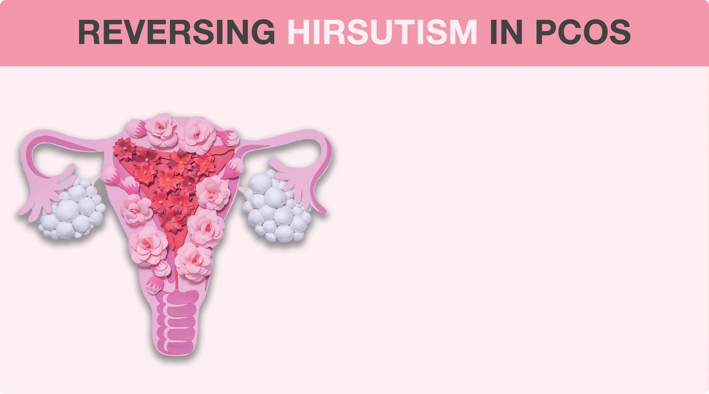 hirsutism pcos treatment