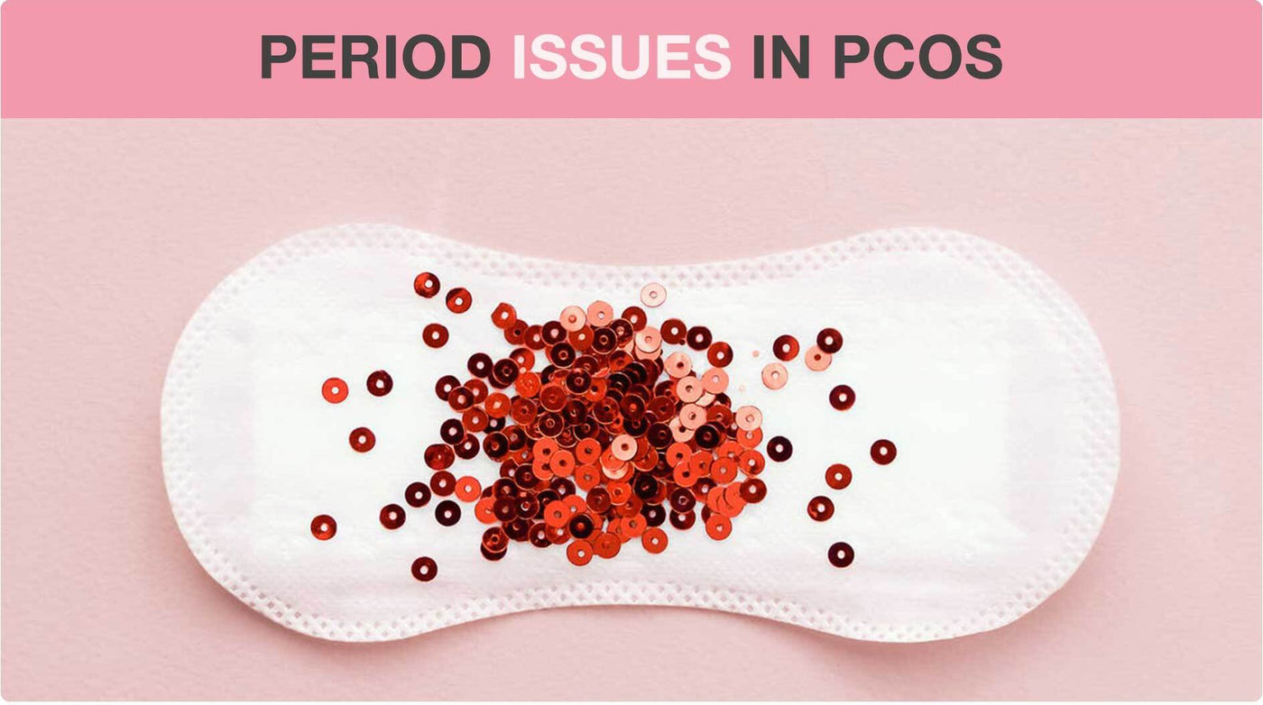 The Source of Period Issues in PCOS